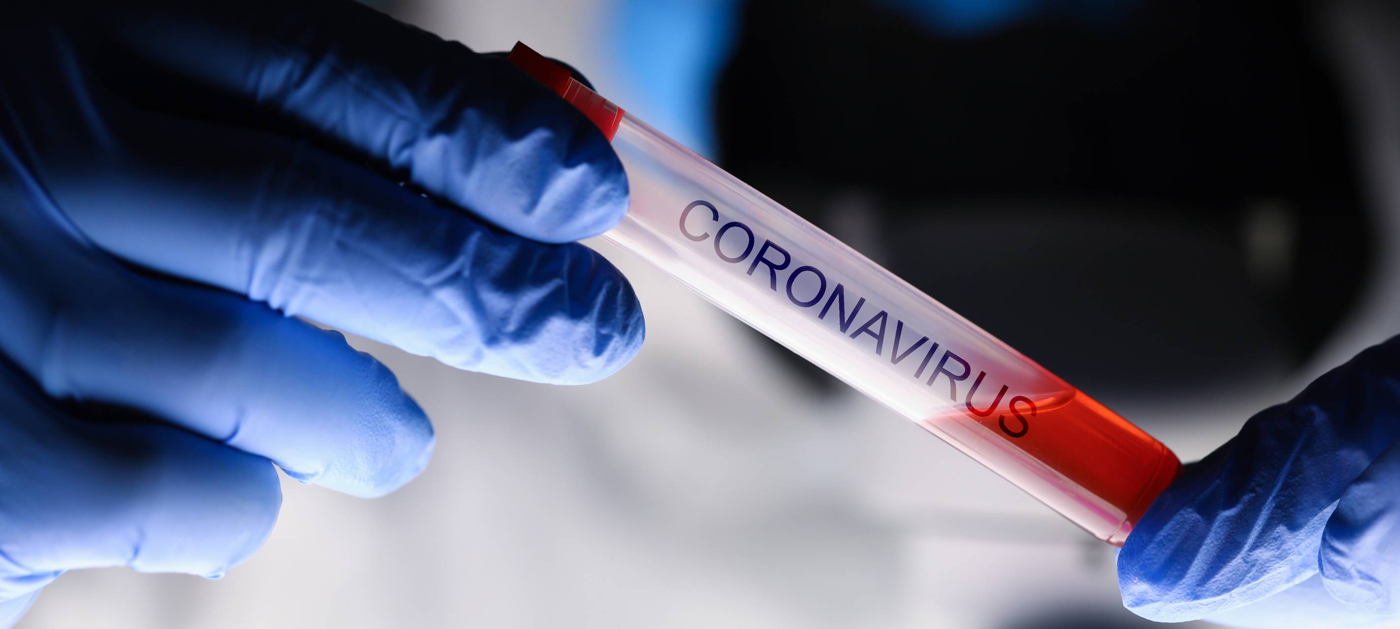 Corona-Inzidenz wieder gesunken